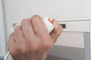 世田谷区で受けたいホワイトニングの治療