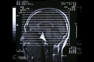 札幌市で評判の高い矯正歯科医院